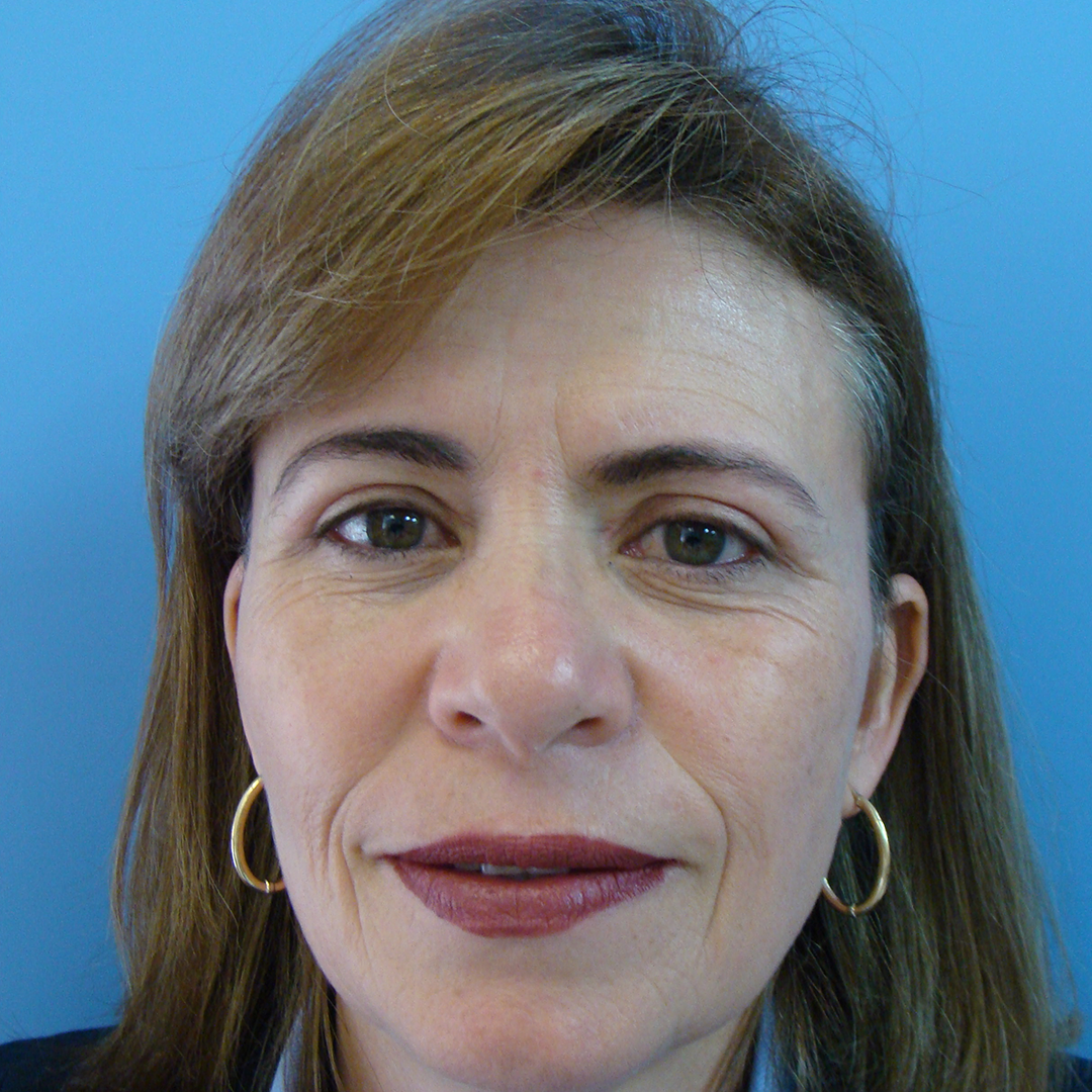 Celam-blefaroplastia-2-5-after