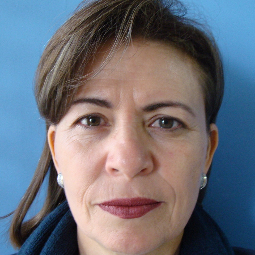 Celam-blefaroplastia-2-5-before
