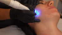 Tania Santos Hidrafacial00091026